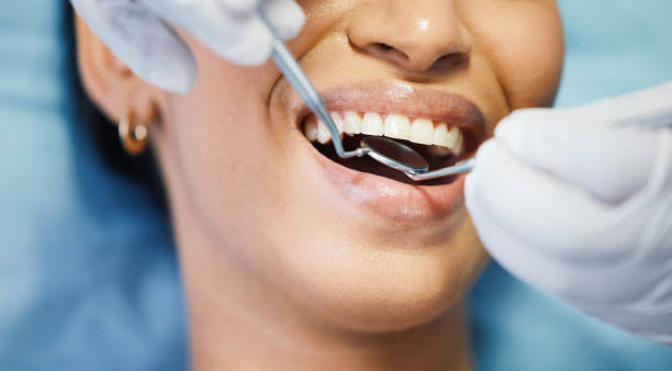 Best Emergency Dental Extractions in Homer, GA