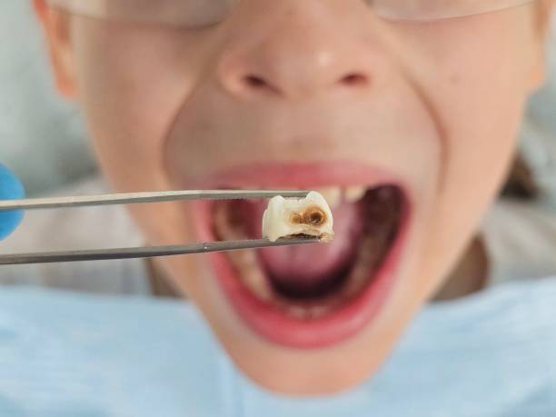 Best Emergency Dentist for Special Needs Patients in Homer, GA